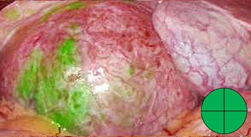 Standard Fluorescence Mode